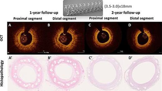 OCT and histological images