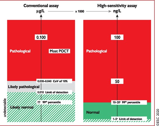 Value of high-sensitivity cardiac troponin. hs-cTn assays (right) are reported in ng/L and provide identical information as conventional assays (left, reported in μg/L) if the concentration is substantially elevated, e.g. above 100 ng/L. In contrast, only hs-cTn allows a precise differentiation between ‘normal’ and mildly elevated. Therefore, hs-cTn detects a relevant proportion of patients with previously undetectable cardiac troponin concentrations with the conventional assay who have hs-cTn concentrations above the 99th percentile possibly related to AMI. ??? = unknown due to the inability of the assay to measure in the normal range;6–8,10–13,29–31 AMI = acute myocardial infarction; CoV = coefficient of variation; hs-cTn = high-sensitivity cardiac troponin; POCT = point-of-care test. aThe limit of detection varies among the different hs-cTn assays between 1 ng/L and 5 ng/L. Similarly, the 99th percentile varies among the different hs-cTn assays, mainly being between 10 ng/L and 20 ng/L. Listen to the audio guide of this figure online.
