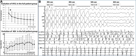 Evolution of ventricular fibrillation in the initial seconds—transition to disorganized ventricular fibrillation. (A) Evolution of ventricular fibrillation frequency (top) and organization (bottom) as a function of time. Ventricular fibrillation cycle length is measured every 2 s on body-surface mapping and the average of right ventricle and left ventricle cycle lengths used. The maximal cycle length decrease over all recorded ventricular fibrillation time (P < 0.001*) occurred in the initial 4 s (window 2–4 s compared with 0–2 s). Ventricular fibrillation organization is quantified every second by a non-dipolar component index (NDI) measuring QRS complex dispersion over the body-surface leads. The duration of organized phase was based on an NDI value <3% indicating organized ventricular fibrillation, whereas a value ≥3% indicated disorganized ventricular fibrillation.12 (B) Transition to disorganized ventricular fibrillation in one patient. Large waveforms on the electrocardiogram and discrete endocardial electrograms are seen at the initial 4 s. Subsequently, the acceleration of the frequency is associated with fragmentation of endocardial electrograms (at 4–5 s) then fine fibrillatory waves on the electrocardiogram. The spatial organization assessed by the non-dipolar component index is indicated for every second.