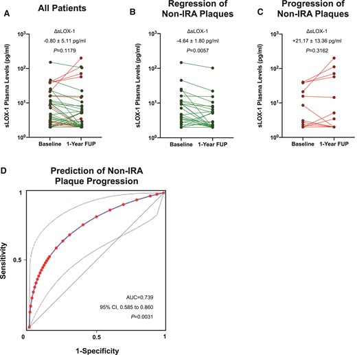 Trajectories of soluble LOX-1 and associated coronary plaque volume changes in patients on statin therapy. (A) Line plot showing paired soluble LOX-1 plasma levels at baseline and 1-year follow-up in all patients. (B) Mean change in soluble LOX-1 plasma levels over 1 year in patients with coronary plaque volume regression. (C) Plasma soluble LOX-1 levels at both baseline and 1-year follow-up in subjects with plaque volume progression in non-infarct-related arteries. (D) Receiver operating characteristic curve (fitted) and corresponding area under the curve for the correct classification of plaque progression/regression in non-infarct-related arteries according to absolute changes in sLOX-1 (ΔsLOX-1). Note that grey lines indicate the corresponding 95% confidence interval. AUC, area under the curve; CI, confidence interval; non-IRA, non-infarct-related arteries; ROC, receiver operating characteristic curve; sLOX-1, soluble lectin-like oxidized low-density lipoprotein receptor-1.