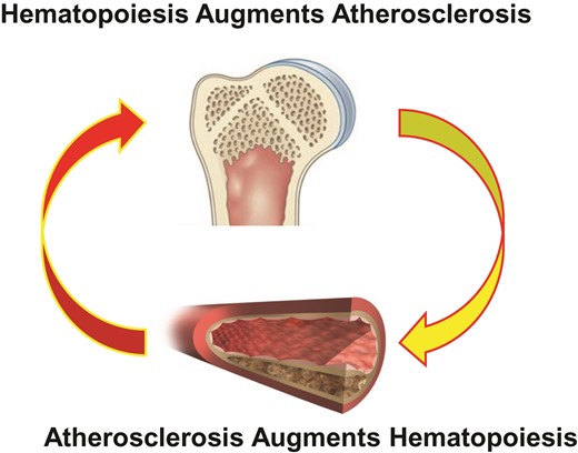 A combination of experimental results and the new human observations of Devesa et al. indicate that haematopoiesis can drive atherosclerosis. Laboratory evidence shows that hypercholesterolaemia in mice can boost haematopoiesis. The bi-directional positive feedback loop depicted here could contribute to progression of atherosclerosis and ongoing risk in individuals with atherosclerosis. Taming bone marrow activation may furnish a new biomarker for therapeutic effects of interventions and a new target for treatment.
