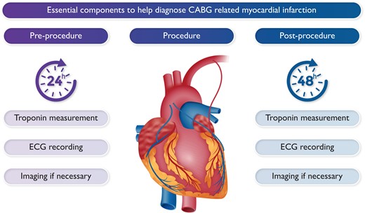 Essential components to help diagnose CABG-related myocardial infarction.