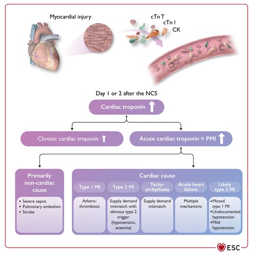 Differential diagnosis of elevated post-operative cardiac troponin concentrations.