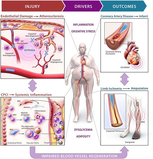 During cardiometabolic based chronic disease, dysglycemia and excess adipocity induce a differentiate imbalance in the bone marrow that contribute to overproduction of inflammatory cells and impaired mobilization of progenitor cells that mediate endogenous mechanisms for vessel repair and regeneration.