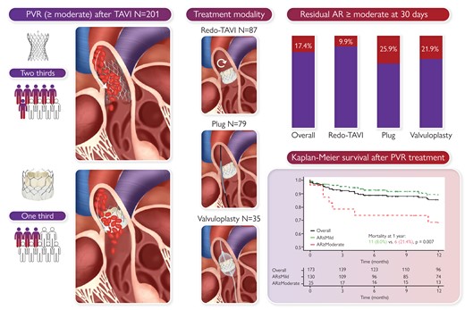 Transcatheter treatment of paravalvular regurgitation (PVR) after transcatheter aortic valve implantation (TAVI) using redo-TAVI, plug closure, or balloon valvuloplasty. Out of 201 patients, the failed valve was self-expanding in two-thirds and balloon-expandable in one-third of the patients. There were 87 patients (43%) who underwent redo-TAVI, 79 (39%) plug closure, and 35 (18%) balloon valvuloplasty. At 30 days, aortic regurgitation (AR) ≥ moderate persisted in 33 (17.4%): 8 (9.9%) after redo-TAVI, 18 (25.9%) after plug closure, and 7 (21.9%) after valvuloplasty (P = 0.036). Regardless of treatment strategy, patients with persistent AR ≥ moderate had higher 1-year mortality compared with those in whom AR was reduced to ≤ mild.16