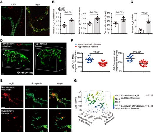 Lymphatic endothelial A2AR expression is altered in high-salt diet-induced hypertensive mice and patients. (A) Representative whole-mount staining of A2AR and LyVE1 in ears of mice fed with low-salt diet and high-salt diet. Scale bar: 100 μm. (B) Quantification of the fluorescent intensity of A2AR and LyVE1 and serum adenosine concentration in mice fed with low-salt diet and high-salt diet. n = 6. (C) A2AR expression by quantitative polymerase chain reaction in lymphatic endothelial cells of skin tissues of mice fed with low-salt diet and high-salt diet. n = 6. (D) Representative images of A2AR and podoplanin coimmunolabeling-enabled 3D imaging of solvent-cleared normotensive and hypertensive human skin tissue. Arrowheads indicate lymphatic endothelial cells. Scale bar: 300 μm. (E, F) Representative coimmunostaining of A2AR and podoplanin in normotensive and hypertensive human skin tissue (E) with quantification of the fluorescent intensity of A2AR and podoplanin immunostaining in lymphatic endothelial cells (F). Scale bar: 50 μm. (G) Relationship between A2AR or podoplanin expression and blood systolic blood pressure in human. Data in (B), (C), and (F) are presented as mean ± standard error mean and an unpaired two-tailed t test was performed to calculate significance between two groups. Data in (G) was analyzed by simple linear regression and visualized using the software Origin Pro 9.0, and the Pearson correlation was calculated as the square root of r2. P < 0.05 was considered as statistically significant. LSD, low-salt diet; HSD, high-salt diet.