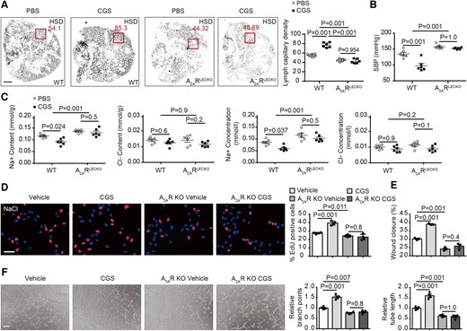 Pharmacological stimulation of A2AR decreases blood pressure and increases lymphangiogenesis and skin Na+ clearance. (A) Representative whole-mount staining of LyVE1 in ears of high-salt diet–fed A2ARLECKO and wild-type mice with and without A2AR agonist CGS21680, with quantification of lymphatic capillary density at the right. n = 6. The squares indicate the typical area used for quantification of lymph capillary density in ears. Scale bar: 2 mm. (B) Systolic blood pressure in A2ARLECKO and wild-type mice fed with high-salt diet, with and without CGS21680. n = 6. (C) Skin Na+ and Cl− content and concentration in the same mice fed with high-salt diet. n = 6. (D) Cell proliferation assessed by EdU staining with quantification at the right in NaCl-treated A2AR knockout and control wild-type human lymphatic endothelial cells, with and without CGS21680. n = 4. Scale bar: 50 μm. (E) Cell migration assessed by wound healing in NaCl-treated A2AR knockout and control wild-type human lymphatic endothelial cells, with and without CGS21680. n = 3. (F) Representative images of tube formation with quantification of branch points and tube length at the right in NaCl-treated A2AR knockout and control wild-type human lymphatic endothelial cells, with and without CGS21680. n = 4. Scale bar: 100 μm. All data are presented as mean ± standard error mean. Data in (A)–(C) were analyzed by two-way ANOVA. Data in (D)–(F) were analyzed by one-way ANOVA. P < 0.05 was considered as statistically significant. CGS, A2AR agonist CGS21680; HSD, high-salt diet; WT, wild-type; KO, knockout.
