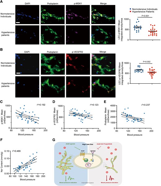 Expression levels of phosphorylated VEGFR2 and MSK1 positively correlate with lymphatic markers in human skin tissues with hypertension. (A, B) Representative immunostaining of p-MSK1 (A) and p-VEGFR2 (B) in normotensive and hypertensive patients with quantification of integrated density per area at right. Scale bar: 50 μm. (C–F) Relationship of skin phosphorylated MSK1 (C), p-VEGFR2 (D), and podoplanin (E) expression and Na+ content (F) with systolic blood pressure in normotensive and hypertensive patients. (G) Model of lymphatic endothelial A2AR-mediated VEGF-independent activation of VEGFR2 signaling in dermal lymphangiogenesis and sodium balance. Data in (A) and (B) are presented as mean ± standard error mean and were analyzed by unpaired two-tailed t test. Data in (C)–(F) were analyzed by simple linear regression, and the Pearson correlation was calculated as the square root of r2. P < 0.05 was considered as statistically significant. intDen, integrated density.