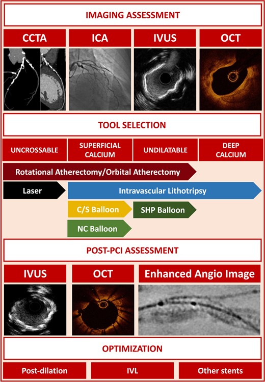 Summary of the main points of the consensus document. In the central section of the figure, the indication for each tool according to the type of calcified lesion is represented. Abbreviations: CCTA, coronary computed tomography angiography; ICA, invasive coronary angiography; IVUS, intravascular ultrasound; OCT, optical coherence tomography; NC, non-compliant; C/S, cutting/scoring; PCI, percutaneous coronary intervention; SHP, super-high-pressure; IVL, intravascular lithotripsy.