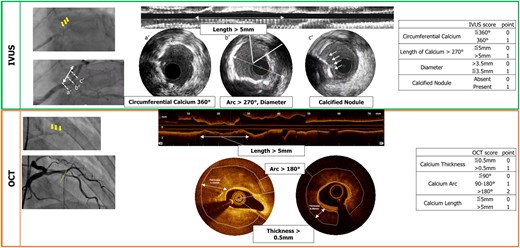 Scoring systems of calcified lesions on intravascular ultrasound and optical coherence tomography.