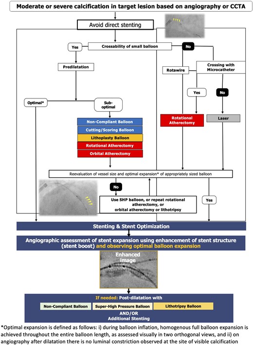 Optimal interventional management of calcified lesions based on coronary angiography.