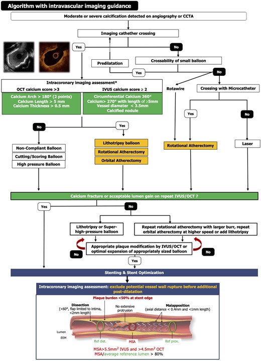Optimal interventional management of calcified lesions based on intravascular imaging.