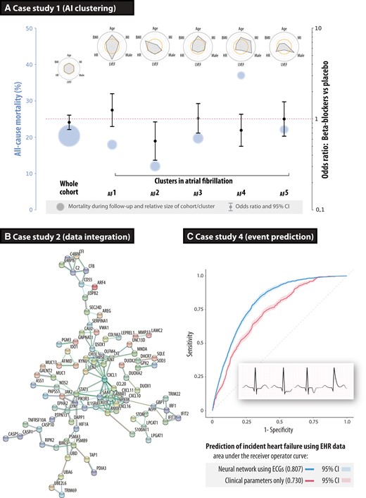 Case studies on how to improve phenotyping of patients. (A) Case study 1 using an artificial intelligence pipeline to cluster patients across nine clinical trials in patients with heart failure, reduced ejection fraction, and concomitant atrial fibrillation. Circles represent the average mortality risk (size relative to the number of patients in that cluster), with odds ratios for the efficacy of beta-blockers vs. placebo for all-cause mortality, and radar plots summarizing descriptors for each cluster compared with the cohort average (open orange circles at the centre of each radar plot). Reproduced and amended from.3 (B) Case study 2 showing the gene–gene interaction network of the top genes based on integrating transcriptomics and inflammation markers in patients with primary sclerosing cholangitis-inflammatory bowel disease and ulcerative colitis, externally validating the group sparse two-way orthogonal partial least squares approach.12 (C) Case study 4 depicting receiver operating characteristic curves for incident heart failure prediction in routine clinical practice, demonstrating superiority of the deep neural network model derived from digital electrocardiograms compared with clinical parameters (P < 0.00001). AF, atrial fibrillation; ECG, electrocardiogram; EHR, electronic healthcare records
