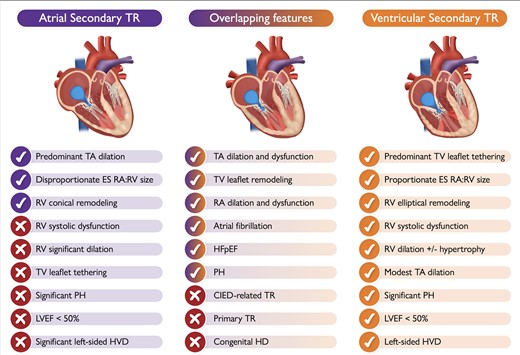 Characteristic aspects of atrial vs. ventricular secondary tricuspid regurgitation and the possible overlapping features that may occur between the two typical phenotypes (the check mark means ‘presence of’; the tick means ‘absence of’). Depending on its etiology, some of the listed features of ventricular secondary tricuspid regurgitation may be absent in some patients (LVEF < 50%, left-sided VHD etc). CIED, cardiac implantable electronic device; ES, end-systolic; HD, heart disease; HFpEF, heart failure with preserved ejection fraction; HVD, heart valve disease; LVEF, left ventricular ejection fraction; PH, pulmonary hypertension; RA, right atrium; RV, right ventricle; TA, tricuspid annulus; TR, tricuspid regurgitation; TV, tricuspid valve.