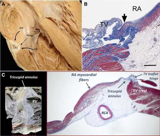 Anatomical relationship of the tricuspid annulus with right atrial and right ventricular myocardial fibres. (A) Atrioventricular junction, showing the insertion of the tricuspid valve leaflets; (B) Extension of right atrial myocardium at the base of the tricuspid valve leaflets, which is less present on the left side; (C) Close anatomical relationship of the tricuspid annulus with the atrial and ventricular myocardium (adapted with permission from Kato et al., Schlossbauer et al., and Muraru et al.28–30). AW, atrial wall; CS, coronary sinus; EAT, epicardial adipose tissue; RA, right atrial; RCA, right coronary artery; RV right ventricular; TV, tricuspid valve; VW, ventricular wall
