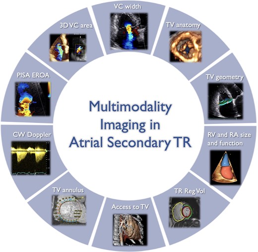 Role of multi-modality imaging for the comprehensive characterization of atrial secondary tricuspid regurgitation patients. 3D, three-dimensional; A-STR, atrial secondary tricuspid regurgitation; CW, continuous wave; EROA, effective regurgitant orifice area; PISA, proximal isovelocity surface area; RA, right atrium; Reg Vol, regurgitant volume; RV, right ventricle; TV, tricuspid valve; VC, vena contracta. Image prepared with BioRender software