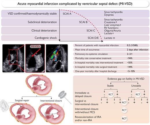 Top panel: Clinical course of ventricular septal defect complicating acute myocardial infarction.