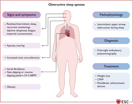 Summary of obstructive sleep apnoea as a common form of secondary hypertension.