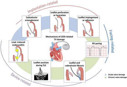 Mechanisms of cardiac implantable electronic device-related tricuspid regurgitation. CIED, cardiac implantable electronic device; RV, right ventricle; TLE, transvenous lead extraction; TV, tricuspid valve.