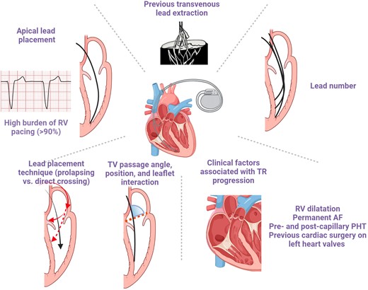 Risk factors of cardiac implantable electronic device-related tricuspid regurgitation. AF, atrial fibrillation; PHT, pulmonary hypertension; RV, right ventricle; TV, tricuspid valve.