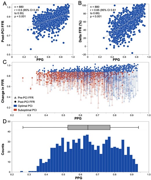 PPG and FFR correlation Pre and Post-PCI