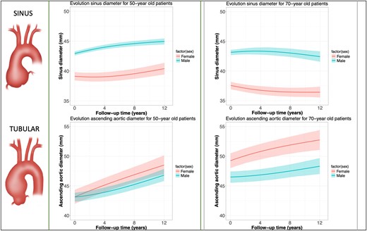 Effect plot from linear mixed-effects model of over 8000 repeated measurements of aortic sinus growth and tubular ascending aneurysm growth for younger (left side, 50 years old) and older patients (right box, 70 years old) with an ascending aortic aneurysm. Explanation: given the inclusion of interaction terms and nonlinear terms in the statistical model, the interpretation of the model coefficients are not straightforward. Effect plots such as this figure can overcome this by depicting the average outcome (here: aortic diameter) along with a 95% confidence interval for specific combinations of predictor levels (here: men vs. women)