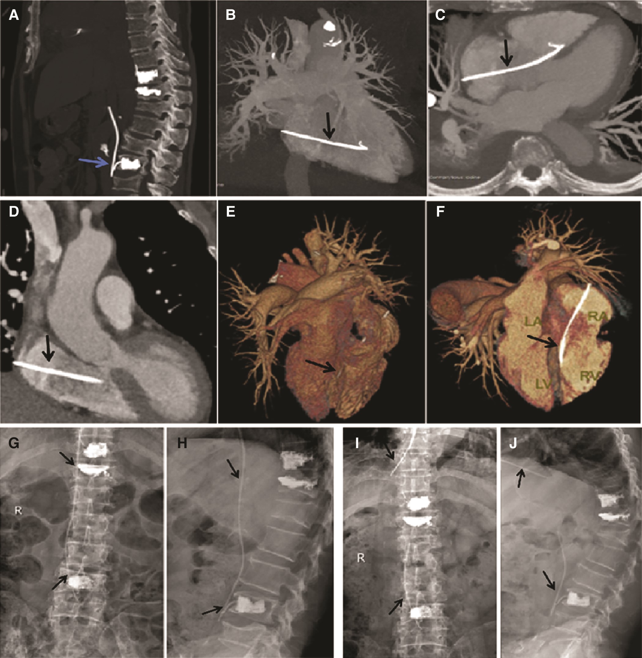 issue cover