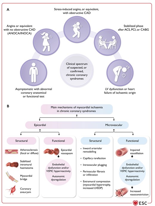 (Central Illustration) Clinical presentations of chronic coronary syndrome and mechanisms of myocardial ischaemia.