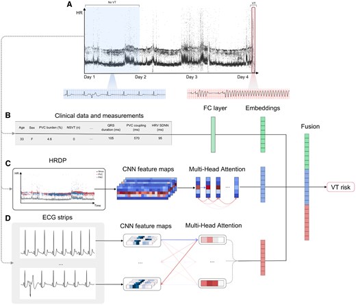 Study design and deep learning–based model. (A) Example heart rate density plot of an ambulatory electrocardiogram recording with no ventricular tachycardia in the first 24 h and an episode of ventricular tachycardia degrading to ventricular fibrillation on Day 4. The first 24 h of the recording are used to derive inputs to the deep learning–based model, while the remaining duration is used to label whether sustained ventricular tachycardia occurred in the following days. (B) Patient age, sex, and various electrocardiogram measurements extracted from the first 24 h are passed to an encoder to generate a measurement embedding. (C) An heart rate density plot is constructed from the first 24 h and passed to a convolutional neural network to extract spatial feature maps, which are passed to a transformer encoder to generate a heart rate density plot embedding. (D) A collection of 10 s electrocardiogram strips is sampled from the 24 h recording and passed to a convolutional neural network to extract features from each strip and then aggregated using a transformer encoder to generate an electrocardiogram waveform embedding. The embeddings generated from each input are fused and passed to a classier to predict a near-term ventricular tachycardia risk score