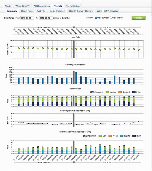 Screenshot of the wearable cardioverter defibrillator remote monitoring website where trends in heart rate, activity, body position, and body angle are visible when the patient is lying down.