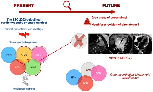 Alt text: Representation of the evolving diagnostic knowledge for cardiomyopathies through a timeline between present and future. In the ‘PRESENT’ section, the diagnostic approach based on the phenotype is depicted, with Venn diagrams representing the cardiomyopathies defined in the ESC 2023 guidelines: HCM (hypertrophic), RCM (restrictive), DCM (dilated), ARVC (arrhythmogenic right ventricle) and NDLVC (non-dilated left ventricle). In the ‘FUTURE’ section, the persistent uncertainties on the current phenotype classification are shown, with Venn diagrams illustrating a hypothetical alternative reclassification of cardiomyopathies: HCM (hypertrophic), RCM (restrictive), DCM (dilated), and ACM (arrhythmogenic).