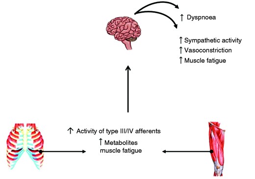 Skeletal muscle (limb and respiratory) metaboreflex activated during fatiguing muscle work due to the accumulation of metabolites and increased activity of type III/IV afferents ,resulting in dyspnoea and increased sympathetic activity and vasoconstriction, exacerbating muscle fatigue and contributing to exercise intolerance.