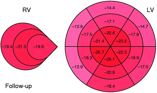 Mean global longitudinal strain score of patients with systemic sclerosis for each ventricular wall segment at follow-up.