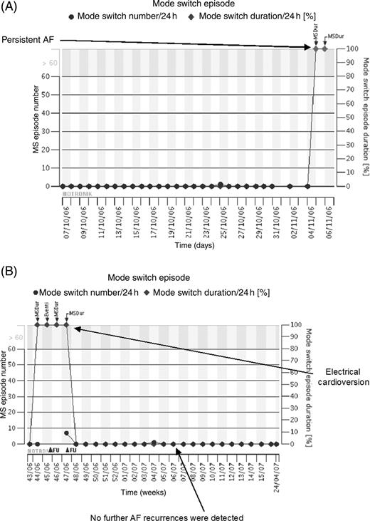 Example of home monitoring trend concerning recurrence of asymptomatic persistent atrial fibrillation. Data are from a 72-year-old woman implanted for Brady–Tachy Syndrome. Circles, number of mode switches; diamonds, mode switch durations as percentage of 24 h. ( A ) After 6 months atrial fibrillation burden suddenly raised from 0 to 100% (persistent atrial fibrillation). The patient was completely asymptomatic. An unscheduled follow-up was considered necessary. ( B ) After an electrical cardioversion was performed and sinus rhythm restored, further atrial fibrillation recurrences were no longer detected.
