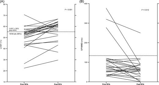 Pre- and post-radiofrequency ablation findings for lower left ventricular ejection fraction and septal-to-posterior wall motion delay. Findings prior to radiofrequency ablation revealed significantly lower left ventricular ejection fraction ( n = 25) ( A ) and prolonged septal-to-posterior wall motion delay ( n = 22) ( B ) when compared with post-radiofrequency ablation findings. Pts, patients.