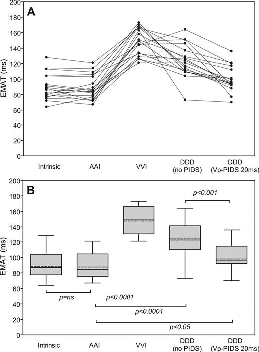 Individual ( A ) and summarized ( B ) values for mean electromechanical activation time (EMAT) in intrinsic rhythm, single- and dual-chamber pacing modes and in the Vp-PIDS 20 ms pacing mode ( n = 18). For description of the box plot design, see legend to Figure 3 . AAI, single-chamber pacemaker mode with lead in the atrium; DDD (no PIDS), DDD mode without diaphragmatic stimulation; DDD (Vp-PIDS 20 ms), DDD mode with diaphragmatic stimulation 20 ms after ventricle stimulation; VVI, single-chamber pacemaker mode with lead in the ventricle.