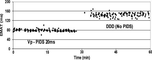 Variability of electromechanical activation time (EMAT) during diaphragmatic stimulation for 1 h in various time-synchronous asymptomatic left ventricular diaphragmatic pacing modes. Each data point in the figure corresponds to the result of a 10 s acoustic cardiography analysis. DDD (no PIDS), DDD mode without diaphragm stimulation; Vp-PIDS 20 ms, DDD mode with diaphragmatic stimulation 20 ms after ventricle stimulation.