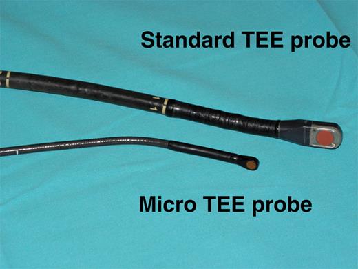 View of the standard TEE and micro-TEE probes.