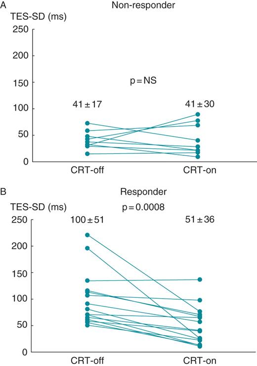 Changes in the mean standard deviations of time to end systole of all 17 left ventricular segments (standard deviation of time to end systole) between temporary cardiac resynchronization therapy suspension (CRT-off) and subsequent cardiac resynchronization therapy resumption (CRT-on) in non-responder (A) or responder (B) patients. The mean standard deviations of time to end systole for non-responder patients at CRT-off and CRT-on were 41 ± 17 and 41 ± 30 ms, respectively (P= NS). The mean standard deviation of time to end systole for responder patients at CRT-off and CRT-on were 100 ± 51 and 51 ± 36 ms, respectively (P= 0.0008).