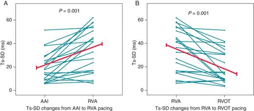 Trends in dyssynchrony index with pacing position. (A) Baseline AAI pacing vs. Right ventricular apical pacing. (B) Right ventricular apical pacing vs. Right ventricular outflow tract pacing. AAI: baseline atrial pacing, RVA: right ventricular apex, RVOT: RV outflow tract, Ts-SD dyssynchrony index: standard deviation for Ts in 12 LV segments.