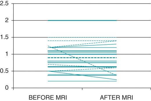 Pacing threshold value modifications after cardiac magnetic resonance imaging. Dashed lines represent atrial leads and continuous lines represent ventricular leads. Thicker lines represent more than one device in the same value.