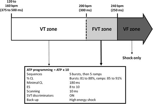 Implantable cardioverter/defibrillator programming parameters. Devices were programmed to deliver 10 ATP attempts for FVT cycle lengths (CL) of 250–300 ms. For CL <250 ms (i.e.>240 b.p.m.), high-energy shocks alone were delivered. Supra-ventricular tachycardia (SVT) discriminators, were programmed up to 240 b.p.m. ATP, antitachycardia pacing; b.p.m. beats per minute; CL, cycle length; ES, extrastimuli; FVT, fast ventricular tachycardia; SVT, supraventricular tachycardia; VF, ventricular fibrillation; VT, ventricular tachycardia.
