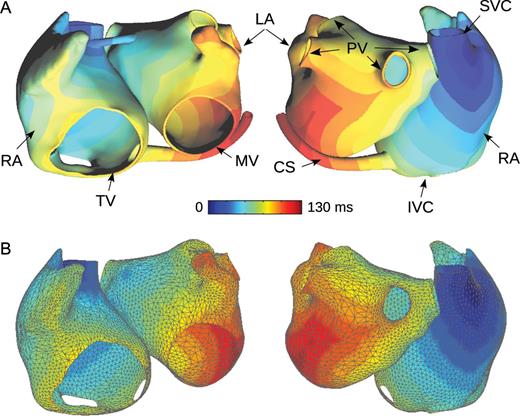 Geometry of a patient-specific atrial model. (A) Full three-dimensional cubic mesh used for running simulations. Activation time simulated during sinus rhythm is colour-coded. (B) Approximate monolayer mesh (triangular mesh) used for designing in silico experiments. Activation times computed in the full three-dimensional model are interpolated in the approximate monolayer mesh and are displayed colour-coded. RA, right atrium; LA, left atrium; PV, pulmonary veins; SVC, superior vena cava; IVC, inferior vena cava; MV, mitral valve; TV, tricuspid valve; CS, coronary sinus.