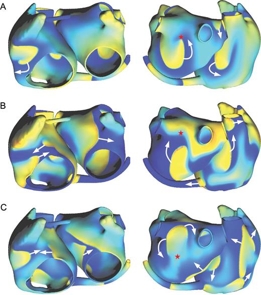 Examples of transmembrane potential maps (left: anterior view; right: posterior view) during simulated atrial fibrillation in three substrates: (A) Kharche substrate; (B) Gong substrate; (C) Kneller substrate. Transmembrane potential is colour-coded, blue corresponding to the resting state and yellow/red to the depolarized state. White arrows represent the direction of depolarization wave propagation. The red stars are referred to in the text.
