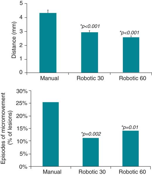 (Top panel) Distance (mean ± SEM) moved by catheter tip measured during robotic and manual radiofrequency ablation, demonstrating greater catheter stability with robotic ablation. (Bottom panel) Episodes of micromovement (defined as an increase in local electrogram voltage during ablation) compared between robotic and manual ablation modalities. *P values comparing each of the robotic groups with manual using Student's T-tests.