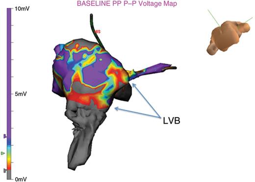 At times there are multiple LVB connections within the CTI. In this example there are three observed.