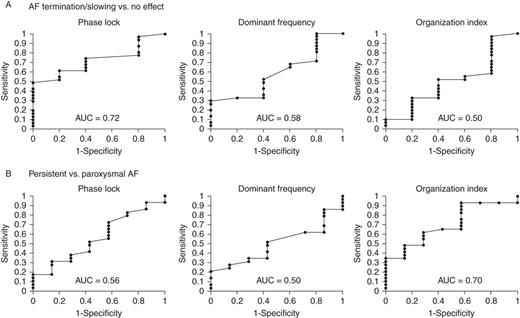 Receiver operating characteristic curves of ECG indices for (A) acute endpoint of AF termination/slowing by FIRM ablation, showing that ECG PL (mean of three planes) provides AUC = 0.72 with optimum cutpoint 0.09, while DF discriminates slightly less well (AUC = 0.58), and OI discriminates poorly (AUC = 0.50). (B) Clinical classification of paroxysmal AF.