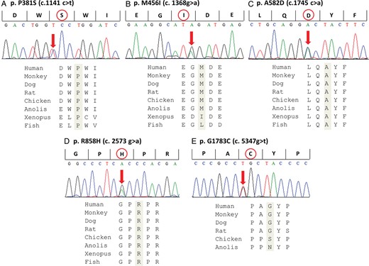 Identified mutations in CACNA1C. Upper: Electropherograms of mutant CACNA1C gene revealing heterozygous transitions. Lower: Amino acid sequence alignments. The amino acids are highly conserved among multiple species.