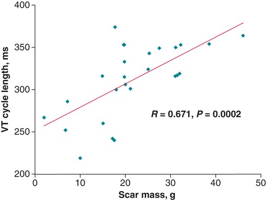 Correlation between the scar mass and the VT cycle length. VT, ventricular tachycardia.