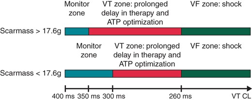 Proposition to optimize ICD post-implantation programming using the scar mass value (proposition that could be used in case of confirmation of our conclusions in a large and prospective study). ATP, antitachycardia pacing; CL, cycle length; VT, ventricular tachycardia.
